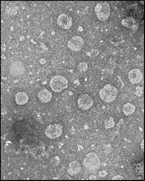 아모레퍼시픽에 따르면 녹차유산균 유래 엑소솜은 사람의 피부 조직과 면역 세포에서 항염증 효과가 있는 것으로 나타났다. /아모레퍼시픽 제공