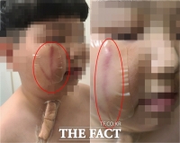  4년이 지나서야 뒤늦게 밝혀진 반복된 목포 M초교 학교폭력