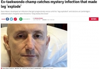  AZ 백신 맞은 태권도 세계 챔피언 다리 절단…'원인 몰라'