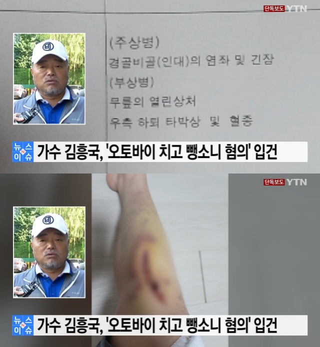 가수 김흥국의 뺑소니를 주장한 오토바이 운전자가 해당 사고로 인해 전치 3주의 부상을 입었다고 주장하며 상처를 공개했다. /YTN 뉴스 캡처
