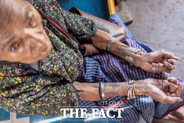 프란체시카(필리핀). 일본군이 강제로 새겨 넣은 군부대 표식으로 보이는 문신이 팔, 다리, 온몸에 남아있다. /겹겹프로젝트 홈피 캡처