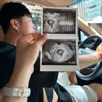  장동민, 이제 두 아이 아빠…'보물이 동생 생겨'