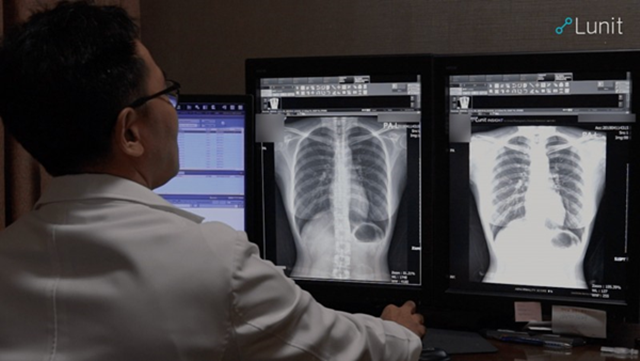 영상의학전문의가 루닛 인사이트 CXR을 사용해 흉부 엑스레이를 분석하고 있다. /루닛
