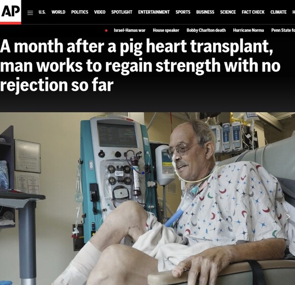 세계에서 2번째로 유전자 변형 돼지 심장을 이식 받은 환자가 한 달째 이상 없이 건강을 회복하고 있다. /AP뉴스 캡처