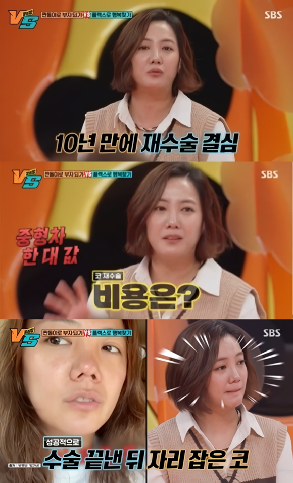 배우 고은아가 SBS 예능프로그램 강심장VS에 출연해 코 재수술 받는 데 9시간이 걸렸다고 털어놨다. /방송 화면 캡처