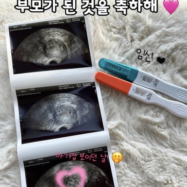 방송인 박수홍 김다예 부부가 임신 소식을 전했다. /박수홍 김다예 유튜브 채널