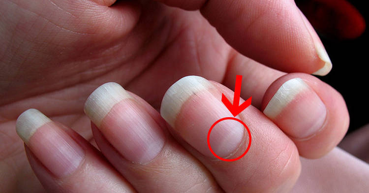 How to Fix a Different Nail Color on Your Ring Finger - wide 10