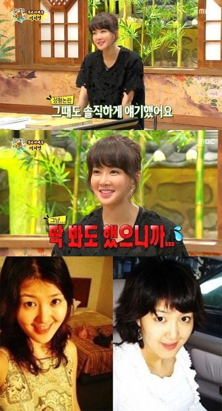 배우 이시영이 과거 사진과 성형수술 논란에 대해 솔직하게 털어놨다. / MBC 캡처, 온라인 커뮤니티