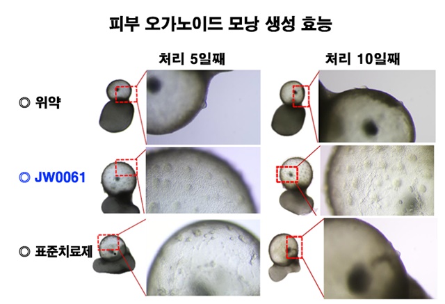 JW중외제약은 Wnt 신호전달경로를 활성화해 모낭 증식과 모발 재생을 촉진시키는 혁신신약 후보물질 JW0061을 연구하고 있다. /JW중외제약