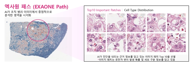 엑사원 패스 2.0은 전체 슬라이드 이미지에서 암과 관련된 유전자 변이를 예측할 수 있다. /LG