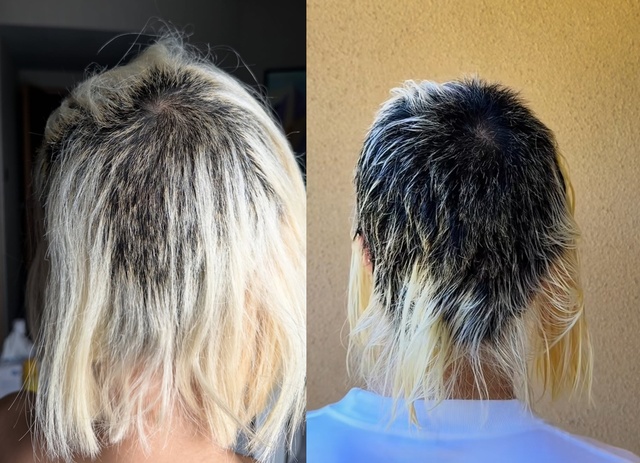 DJ 소다가 미용실에서 탈색한 뒤 머리카락이 끊긴다고 주장한 뒤 40일이 지났지만 상태가 더 악화돼 속상한 마음을 전했다. 왼쪽은 지난 6월 17일 공개한 모습, 오른쪽은 7월 27일 공개한 모습. /DJ 소다 소셜 미디어 영상 캡처