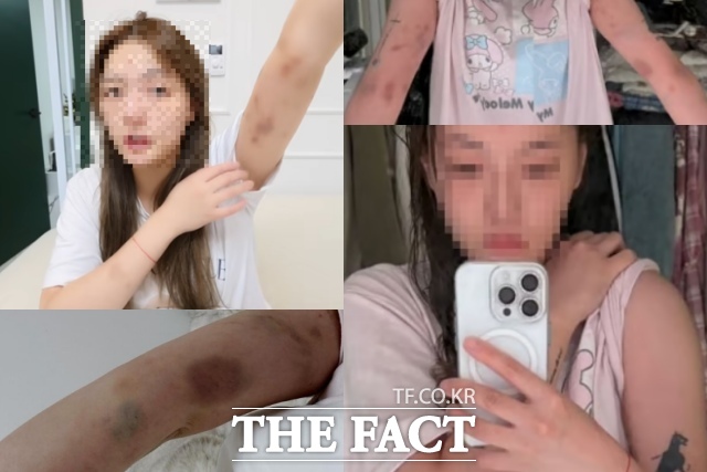 지난 15일 대만 국적 유튜버 A 씨가 전날 밤 서울 마포구 홍대 거리에서 한국인 남성 2명으로부터 폭행을 당한 피해 사실을 자신의 SNS를 통해 알리고 있다. /SNS 갈무리