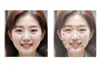  LG생활건강, '비전 AI'로 얼굴 부위별 노화 속도 차이 밝혀