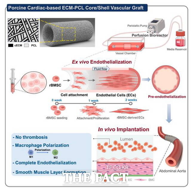 순천향대 연구팀이 심장 유래 세포외기질(cECM) 기반 코어-쉘 인공혈관을 제작해 줄기세포를 바이오리액터에서 배양한 뒤 쥐 복부대동맥에 이식, 혈관내피·평활근 재생과 조직 리모델링 효과를 확인했다. /순천향대학교